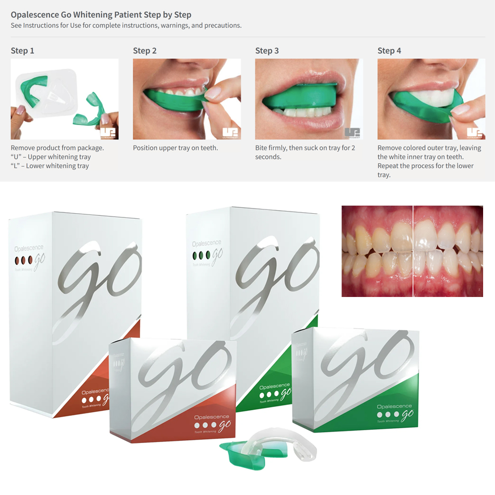 Teeth Whitening Gel Opalescence - Opalescence Go Teeth Whitening Trays Prefilled