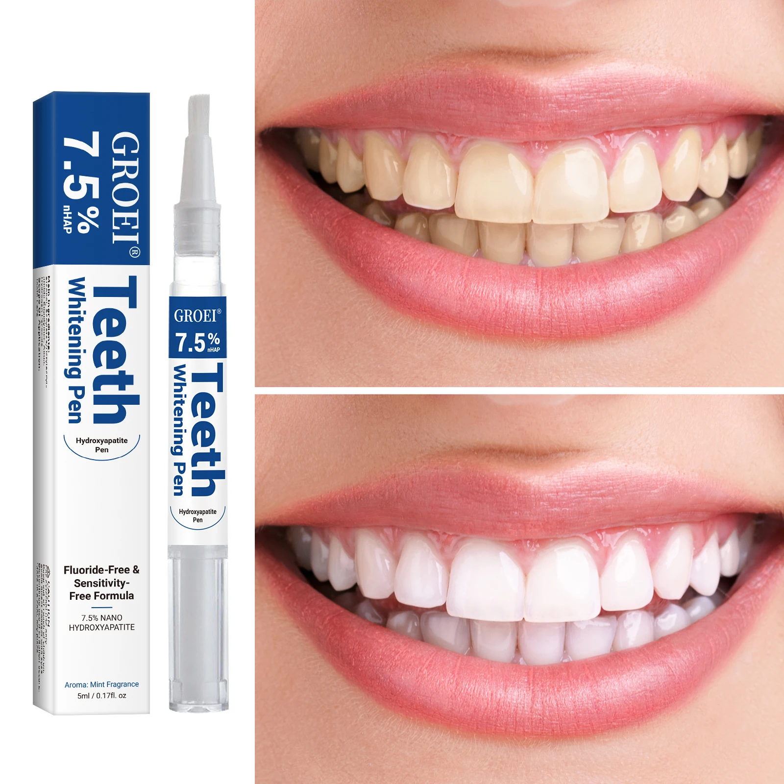 Hydroxyapatite Tooth Whitening – Teeth Whitening Ai Bewertung und Preis