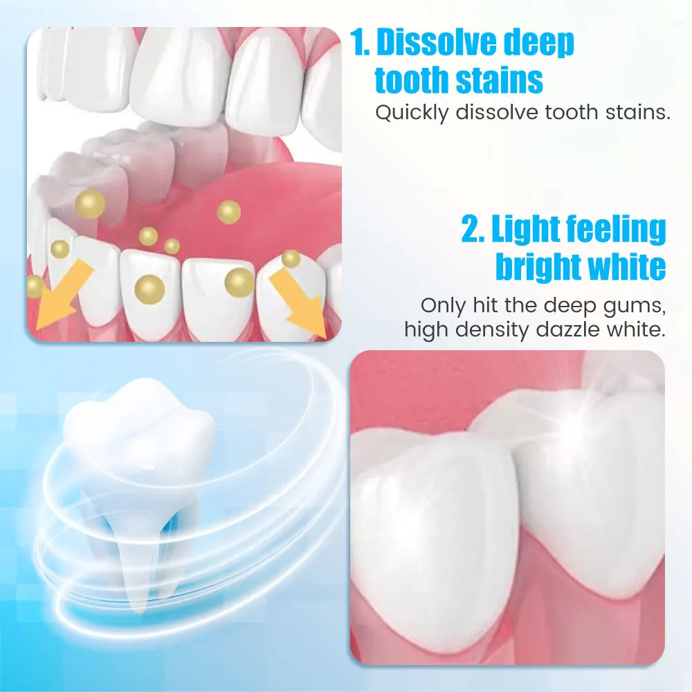 9D Teeth Whitening Stickers Mi – Teeth Whitening Yellow Teeth Bewertung und Preis