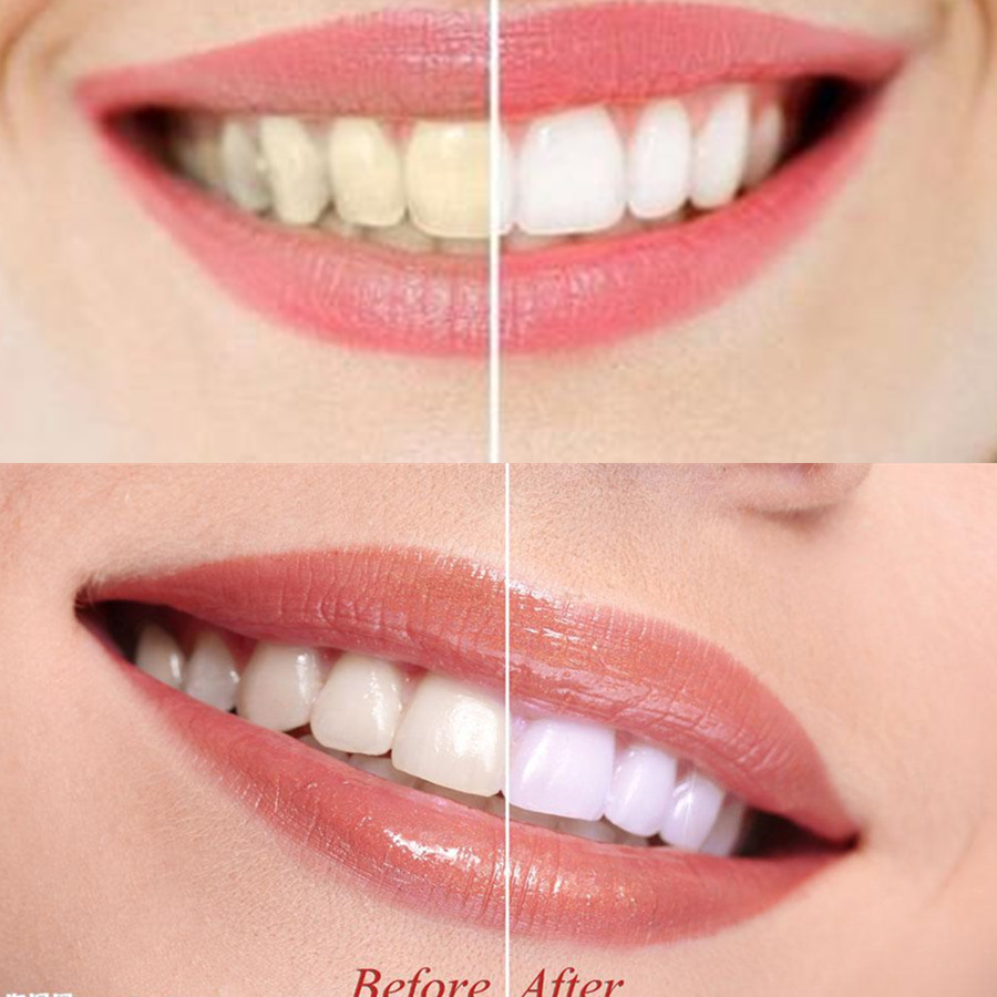 Bamboo Charcoal Teeth Tooth De – Teeth Whitening China Bewertung und Preis