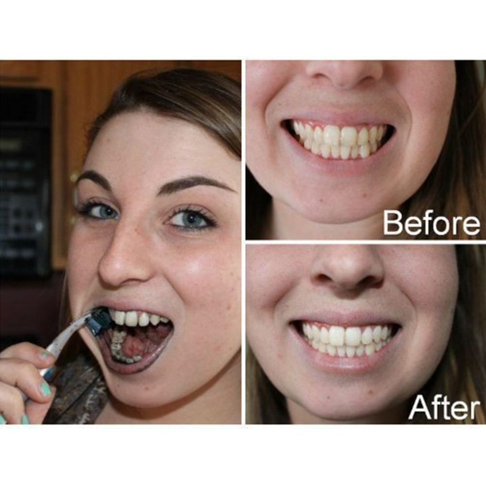Bamboo Charcoal Teeth Tooth De – Teeth Whitening China Bewertung und Preis