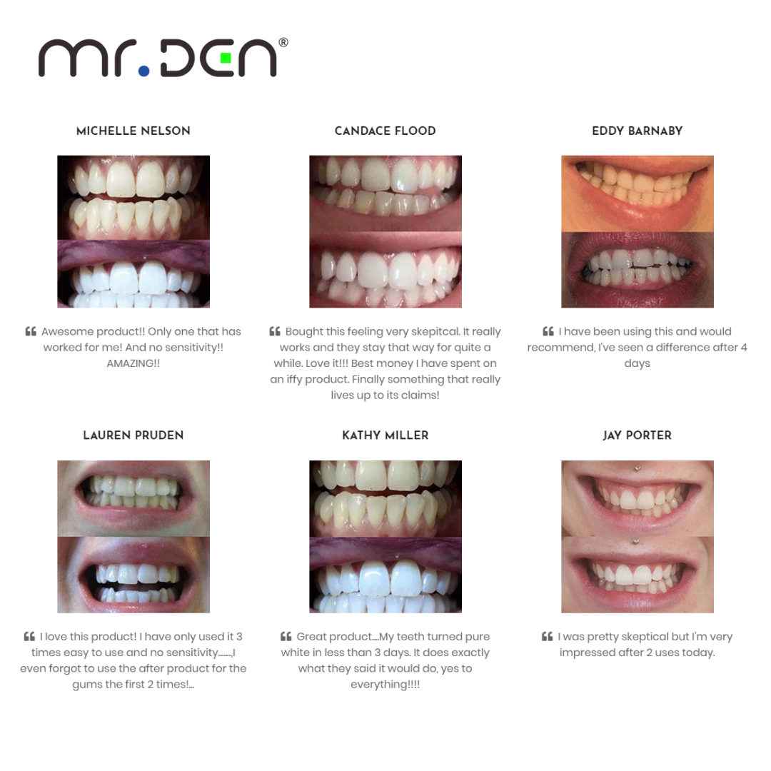 Dr. Whiten 3 Pack Teeth Whiten – Teeth Whitening China Bewertung und Preis
