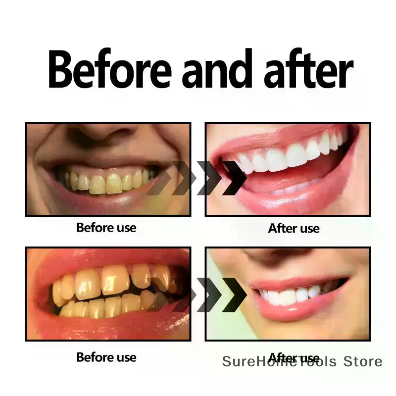 Bamboo Charcoal Powder For Tee – Teeth Whitening Co Bewertung und Preis