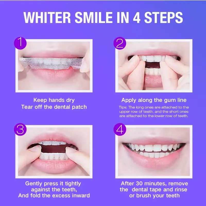 Teeth Whitening Kit - 5X LED L – Teeth Whitening Strips Bewertung und Preis