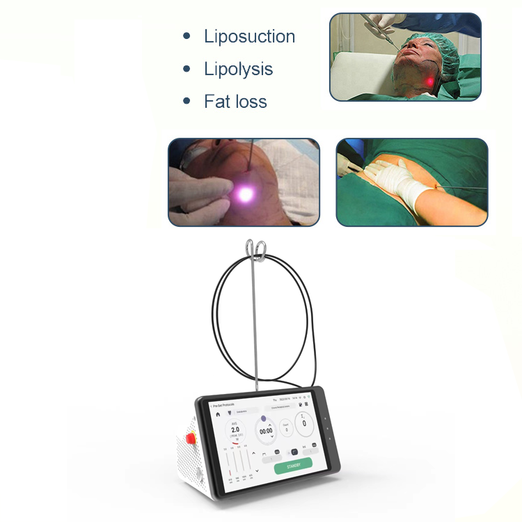 Dental Laser Teeth Whitening D – Teeth Whitening Device Bewertung und Preis