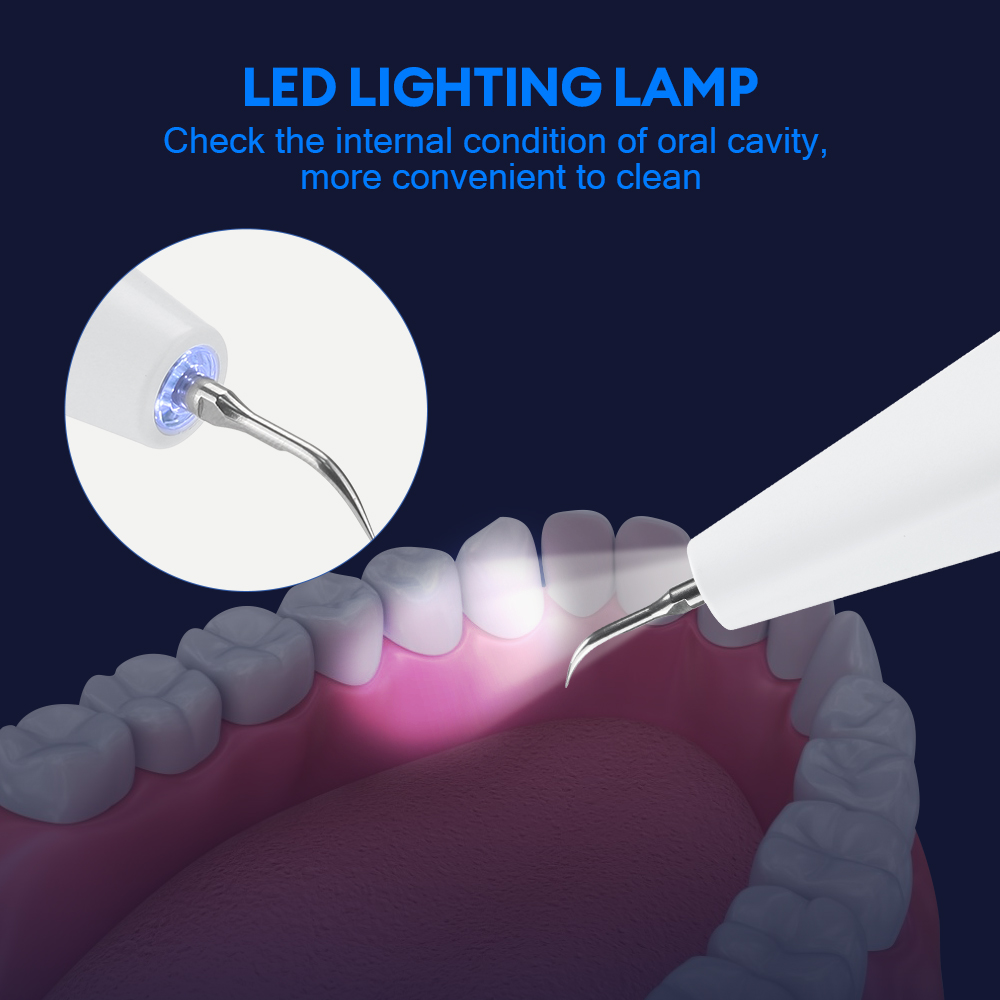 Ultrasonic Dental Calculus Rem – Teeth Whitening Strips Bewertung und Preis