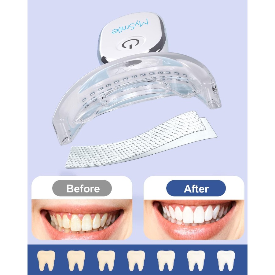 Teeth Whitening Strips Kit wit – Teeth Whitening Strips Bewertung und Preis