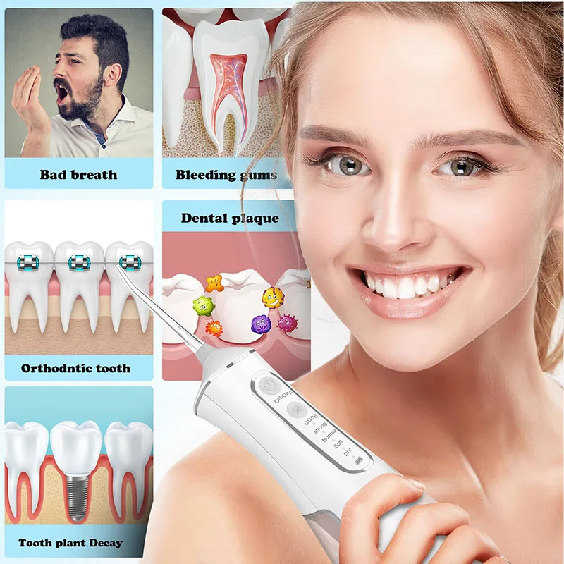 Portable Dental Water Irrigato – Teeth Whitening Laser Bewertung und Preis