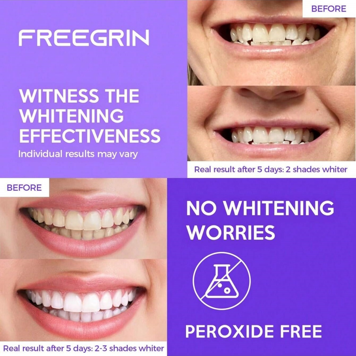 Deluxe Whitening Teeth Sticker – Teeth Whitening Quotes Bewertung und Preis