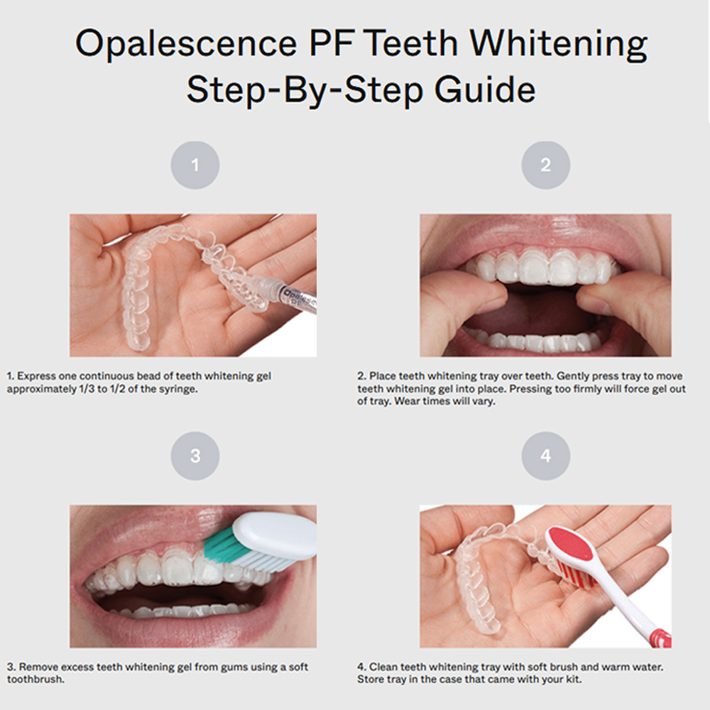 opalescence pf 15% refill kit  – Teeth Whitening Gel Opalescence Bewertung und Preis