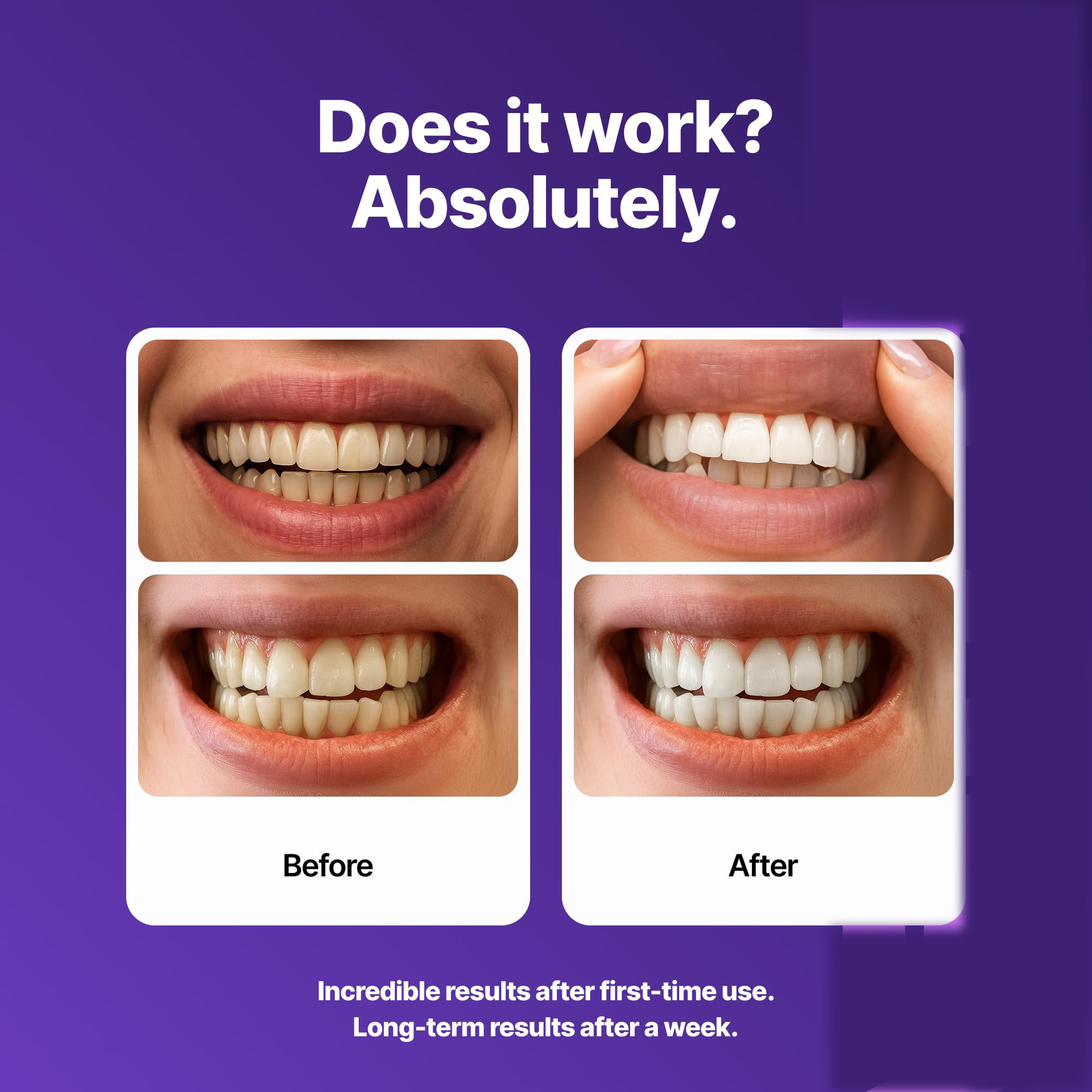 Purple Brightening Dental Patc – Teeth Whitening Yellow Teeth Bewertung und Preis