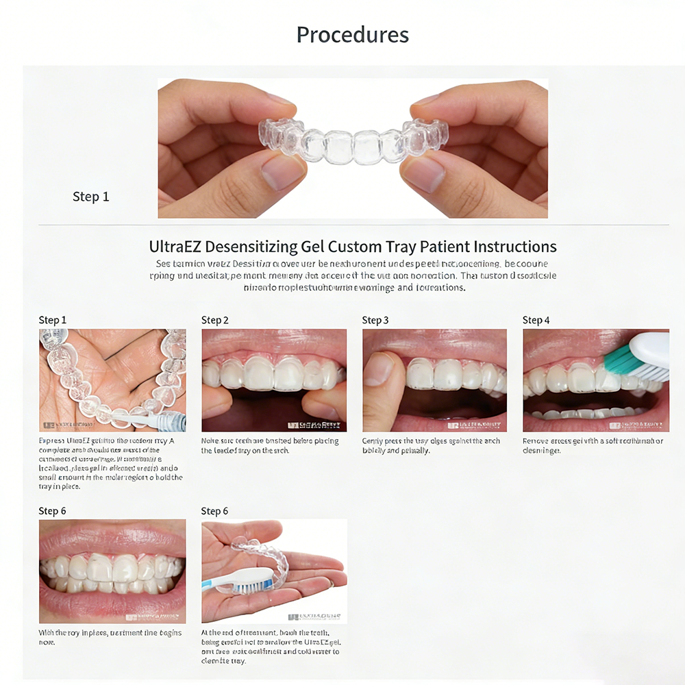 Ultra Ez Dental Desensitizing  – Teeth Whitening Gel Opalescence Bewertung und Preis