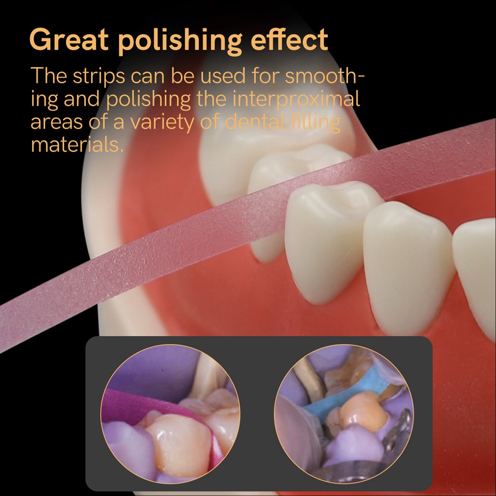1PC Dental Polishing Strip Rol – Teeth Whitening Strips Bewertung und Preis