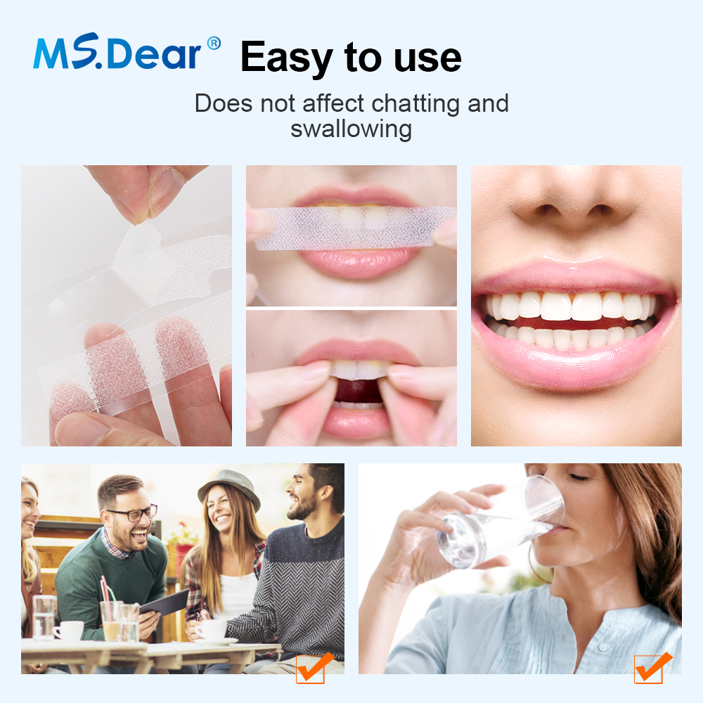 Teeth Whitening Strips Cleansi – Teeth Whitening Ai Bewertung und Preis